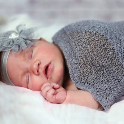How to Get Rid of Baby Acne